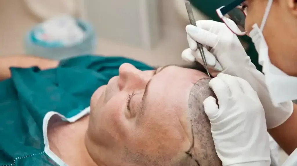 Hair Transplant infection