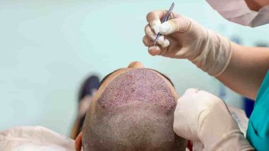 Hair Transplant infection