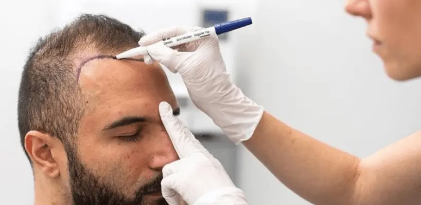 What Are The Symptoms Of Hair Transplant Infection?
