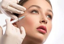 How Long Does It Take For Fillers To Settle
