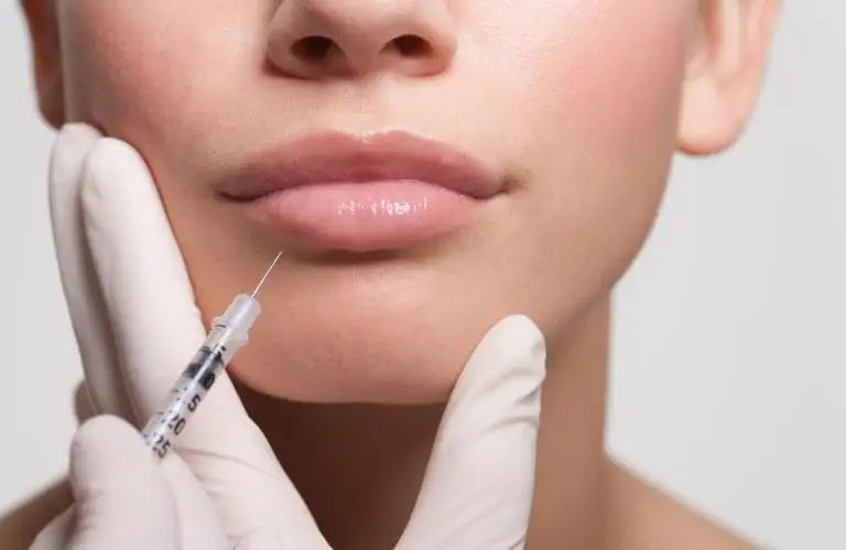 How Long Does It Take For Fillers To Settle?
