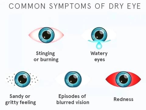 Dry Eyes septoms