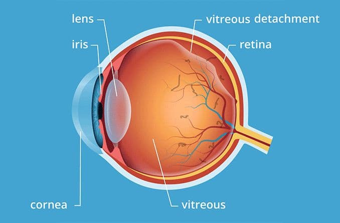 Eye Jelly (Vitreous)