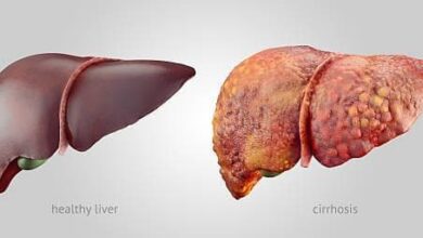 Early Signs Of Liver Disease