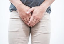 Urinary Incontinence