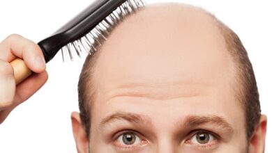 Tips on Treating Male Pattern Hair Loss