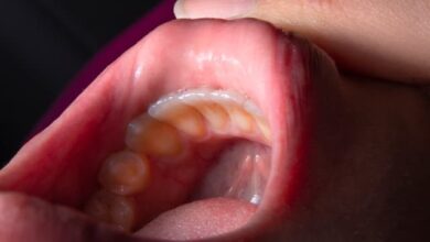 How long until a tooth infection kills you?